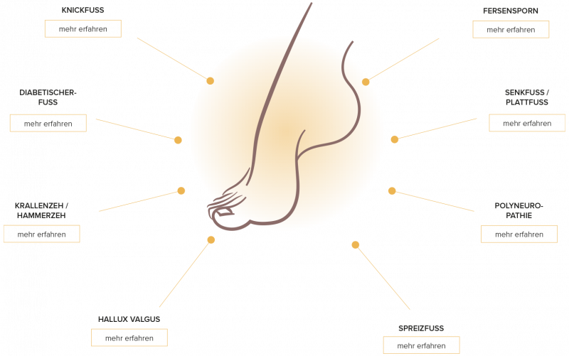 media/image/Banner-Aufz-hlung-Fussfehlstellungen.png