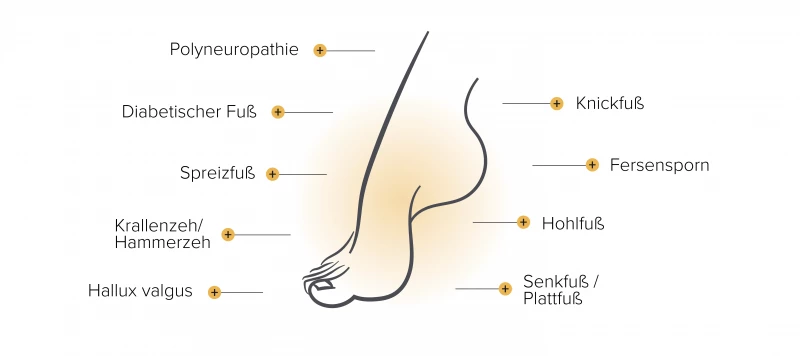 Übersicht von Fußproblemen