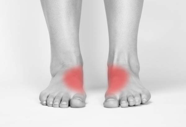 Senkfuss_PlattfussFussbilder_20sw