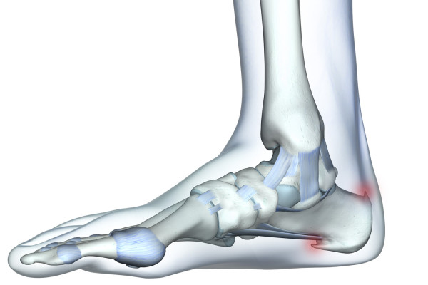 FersenspornJ7NK3yHrA4RRF