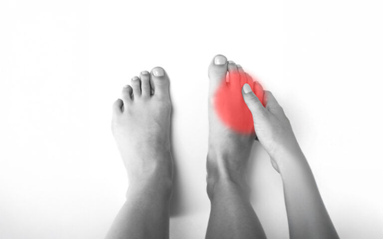 Zwei Füße, rechter Fuß mit rot markiertem Schmerzbereich am Vorfuß – Symbolbild für Fußschmerzen (z. B. Ballen/Hallux valgus)